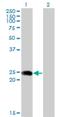 Bridging Integrator 3 antibody, H00055909-M02A, Novus Biologicals, Western Blot image 