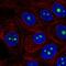 Ribosome Biogenesis Regulator 1 Homolog antibody, HPA060937, Atlas Antibodies, Immunocytochemistry image 