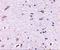 Syntaphilin antibody, A08882, Boster Biological Technology, Immunohistochemistry paraffin image 
