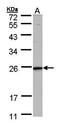 Killer Cell Lectin Like Receptor G1 antibody, orb73562, Biorbyt, Western Blot image 