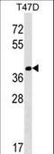 N-Terminal Asparagine Amidase antibody, LS-C158428, Lifespan Biosciences, Western Blot image 