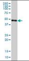 Probable serine carboxypeptidase CPVL antibody, orb89789, Biorbyt, Western Blot image 