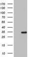 Ectonucleoside Triphosphate Diphosphohydrolase 1 antibody, TA804742, Origene, Western Blot image 
