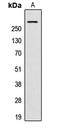 A-kinase anchor protein 13 antibody, LS-C353309, Lifespan Biosciences, Western Blot image 