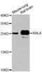 RAS Like Proto-Oncogene A antibody, A0541, ABclonal Technology, Western Blot image 