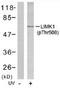 LIM Domain Kinase 2 antibody, TA309981, Origene, Western Blot image 