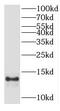 Adipogenesis Associated Mth938 Domain Containing antibody, FNab01007, FineTest, Western Blot image 