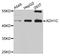 Alcohol Dehydrogenase 1C (Class I), Gamma Polypeptide antibody, STJ111267, St John