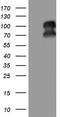 Progesterone Receptor antibody, CF805107, Origene, Western Blot image 