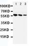 Angiotensinogen antibody, PA5-78741, Invitrogen Antibodies, Western Blot image 