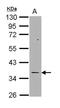 Thymidylate Synthetase antibody, orb74042, Biorbyt, Western Blot image 