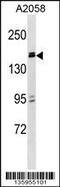 Zinc Finger And BTB Domain Containing 38 antibody, 58-655, ProSci, Western Blot image 