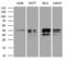 Uracil Phosphoribosyltransferase Homolog antibody, LS-C792242, Lifespan Biosciences, Western Blot image 