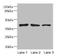 Renin/prorenin receptor antibody, A57277-100, Epigentek, Western Blot image 