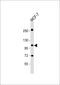 Discoidin Domain Receptor Tyrosine Kinase 1 antibody, 63-112, ProSci, Western Blot image 