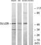 Protein Kinase C Substrate 80K-H antibody, LS-C118785, Lifespan Biosciences, Western Blot image 