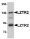 Protein transport protein Sec16B antibody, LS-B5076, Lifespan Biosciences, Western Blot image 