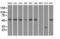 Solute Carrier Family 2 Member 5 antibody, LS-C799755, Lifespan Biosciences, Western Blot image 