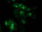Eukaryotic Translation Initiation Factor 4E Family Member 2 antibody, M05869-1, Boster Biological Technology, Western Blot image 