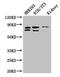 Nuclear pore complex protein Nup85 antibody, CSB-PA874821LA01HU, Cusabio, Western Blot image 