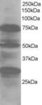 LIM Domain 7 antibody, PA5-18229, Invitrogen Antibodies, Western Blot image 