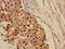 Carnitine O-Acetyltransferase antibody, LS-C669858, Lifespan Biosciences, Immunohistochemistry paraffin image 