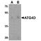 Autophagy Related 4D Cysteine Peptidase antibody, TA349133, Origene, Western Blot image 