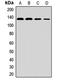 Mannosidase Alpha Class 2A Member 1 antibody, LS-C668190, Lifespan Biosciences, Western Blot image 