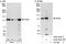 Serine/threonine-protein kinase N2 antibody, A302-444A, Bethyl Labs, Immunoprecipitation image 