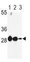 Enoyl-CoA Delta Isomerase 1 antibody, PA5-35362, Invitrogen Antibodies, Western Blot image 
