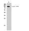Epidermal growth factor receptor substrate 15 antibody, STJ90629, St John