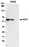 NUF2 Component Of NDC80 Kinetochore Complex antibody, NBP2-32211, Novus Biologicals, Immunoprecipitation image 
