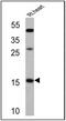 Natriuretic Peptide A antibody, PA3-228, Invitrogen Antibodies, Western Blot image 