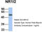 Nuclear Receptor Subfamily 1 Group I Member 2 antibody, TA339538, Origene, Western Blot image 