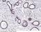 Estrogen Receptor 1 antibody, 100386-T08, Sino Biological, Immunohistochemistry paraffin image 
