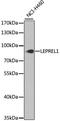 Prolyl 3-hydroxylase 2 antibody, 23-379, ProSci, Western Blot image 