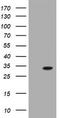 Glutathione S-Transferase Omega 2 antibody, TA504075, Origene, Western Blot image 