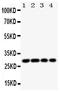 Major Histocompatibility Complex, Class II, DM Beta antibody, PA1788, Boster Biological Technology, Western Blot image 