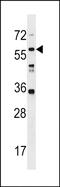 Leucine Rich Repeat Containing 14B antibody, PA5-72089, Invitrogen Antibodies, Western Blot image 