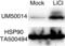 Catenin Beta 1 antibody, LS-C796677, Lifespan Biosciences, Western Blot image 