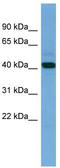 Pyruvate Dehydrogenase E1 Alpha 2 Subunit antibody, TA335716, Origene, Western Blot image 