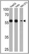 Prolyl 4-Hydroxylase Subunit Beta antibody, MA3-019, Invitrogen Antibodies, Western Blot image 