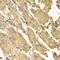 Protein Phosphatase 2 Catalytic Subunit Alpha antibody, 22-419, ProSci, Immunohistochemistry paraffin image 