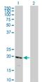 Ring Finger Protein 122 antibody, H00079845-M01, Novus Biologicals, Western Blot image 