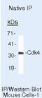 Cyclin Dependent Kinase 4 antibody, MA5-12981, Invitrogen Antibodies, Immunoprecipitation image 