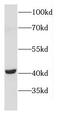 Ciliary neurotrophic factor receptor subunit alpha antibody, FNab01820, FineTest, Western Blot image 