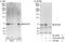 DEAD-Box Helicase 55 antibody, A303-027A, Bethyl Labs, Immunoprecipitation image 