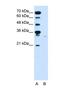 Solute carrier family 22 member 7 antibody, NBP1-69691, Novus Biologicals, Western Blot image 