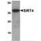 NAD-dependent ADP-ribosyltransferase sirtuin-4 antibody, MBS150681, MyBioSource, Western Blot image 