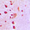 Peroxiredoxin 3 antibody, LS-C353297, Lifespan Biosciences, Immunohistochemistry paraffin image 